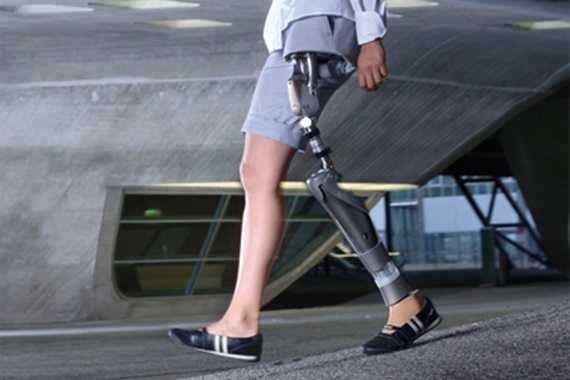 Prótesis articulares de cadera con los cojinetes iglidur® por Otto Bock HealtCare GmbH